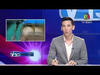 หนุ่ม จ.น่านออกหาปลาพลาดถูกฉมวกแทงตาหวิดบอด | ข่าวรอบวัน | 29 เม.ย. 59