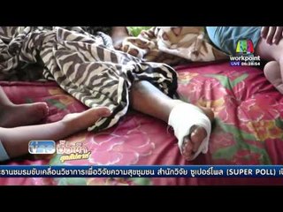 สาวร้อง ถูกรถไล่ชนทำร้าย คดีไม่คืบ | ข่าวมื้อเช้าสุดสัปดาห์ | 8 พ.ค. 59