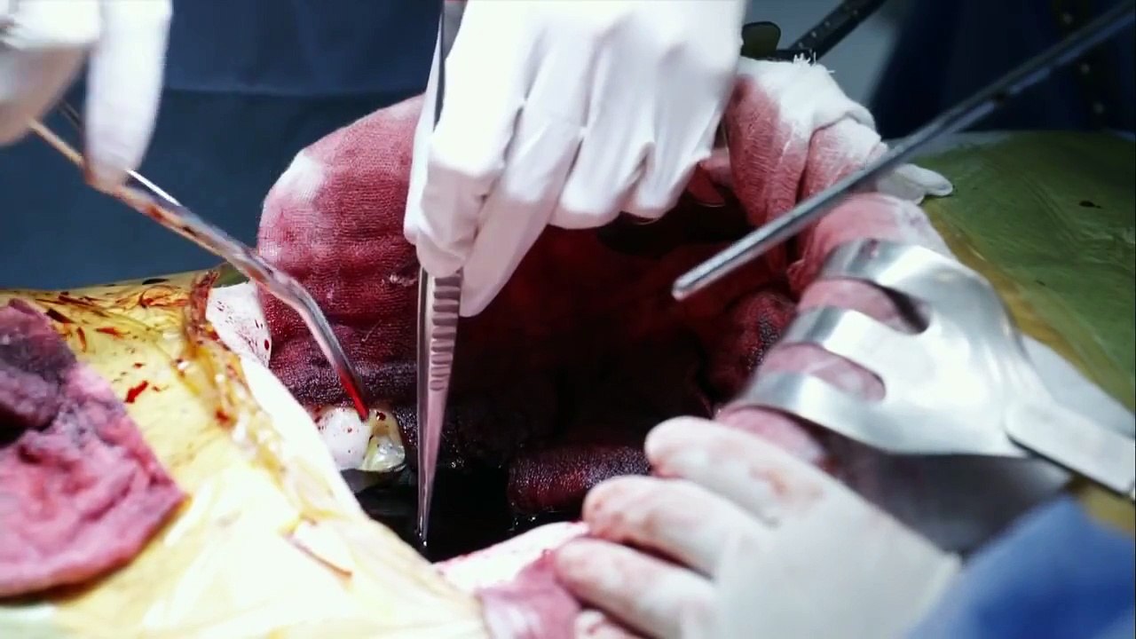 Blood - Cap. 5 (Sub Español)
