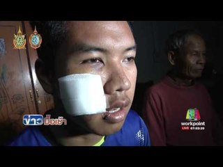 รวบ 4 มือมีดรุมฟัน นศ เทคนิคเหตุเข้าห้องผิดคิดว่าเป็นคู่อริ l ข่าวมื้อเช้า l 7.ก.ย.59