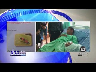 ระวัง”ด้วงก้นกระดก” ดช 11 ขวบโดน บวมพุพอง  l ข่าวเวิร์คพอยท์ (เช้า) l 22 ธ.ค.59