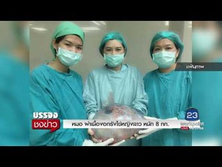 หมอ ผ่าเนื้องอกรังไข่หญิงลาว หนัก 8 กก  l บรรจงชงข่าว l 24 พ.ค.60