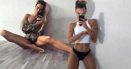 Çocukken Bacaklarıyla Dalga Geçilen Modeli Şimdi Görenler Gözlerini Alamıyor