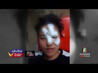 อีจัน  น้องสาวเอิ๊ก ถูกแก้วทุบหน้าจนเสียโฉม l เมืองไทยไก่โห่ l 6 ก.ย.60