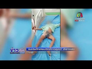 หมอยันเด็กเมียนมาติดเชื้อพิษสุนัขบ้า เสียชีวิตแล้ว l ข่าวเวิร์คพอยท์ l 15 มี.ค.61