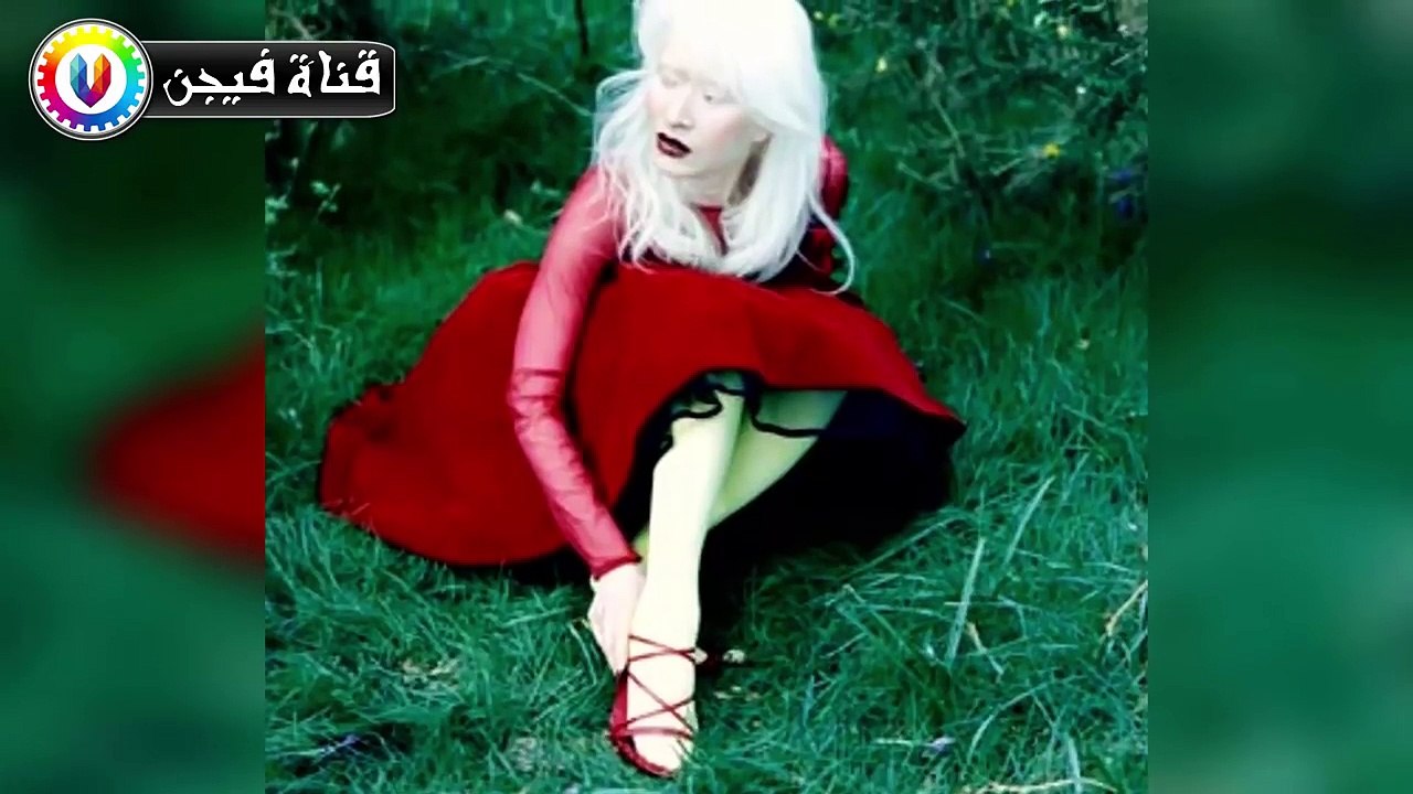 8 أشخاص أدهشوا العالم بلون بشرتهم الفريد .. !!