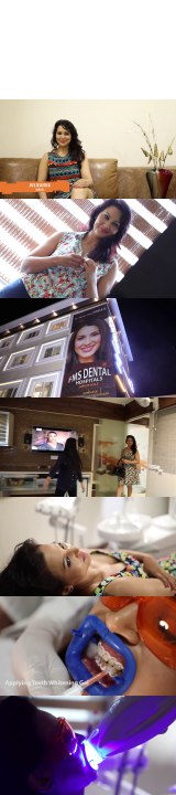 Teeth Whitening- Bleaching in Hyderabad India- Get the Smile you are looking for - FMS DENTAL