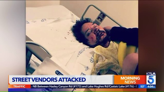 Fruit Vendor Robbed, Nearly Beaten to Death in California