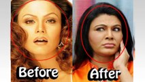 [MP4 1080p] 8 Bollywood Actress Plastic Surgery Gone Wrong _ Then and Now