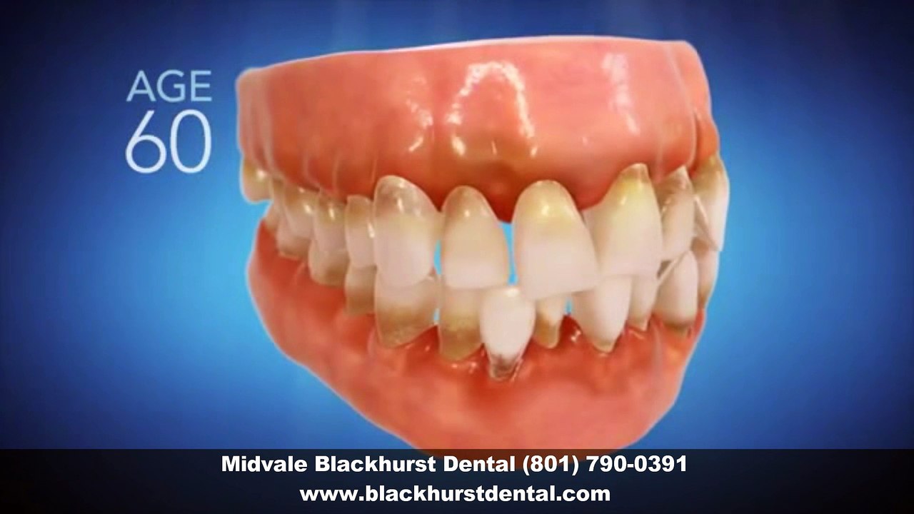 Invisalign Dentist Midvale, UT