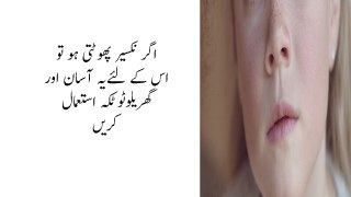 Nakseer Phootne Ka Ka Ilaj Nose Bleeding Treatment At Home In urdu