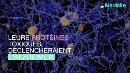 Pourquoi l’apnée du sommeil favoriserait Alzheimer