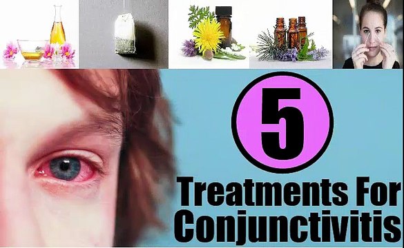 Pink Eye Treatment|Home Remedies to Get Rid from Pink Eyes Naturaly