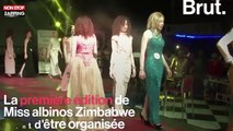 Afrique : des concours de beauté Miss Albinos pour changer les mentalités (Vidéo)