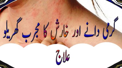 garmi danay khatam karne ka tarika in urdu