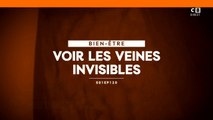 Voir les veines invisibles