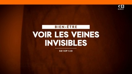 Voir les veines invisibles