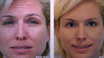 Revitol anti aging cream reviews || Best Anti-aging Cream Ever