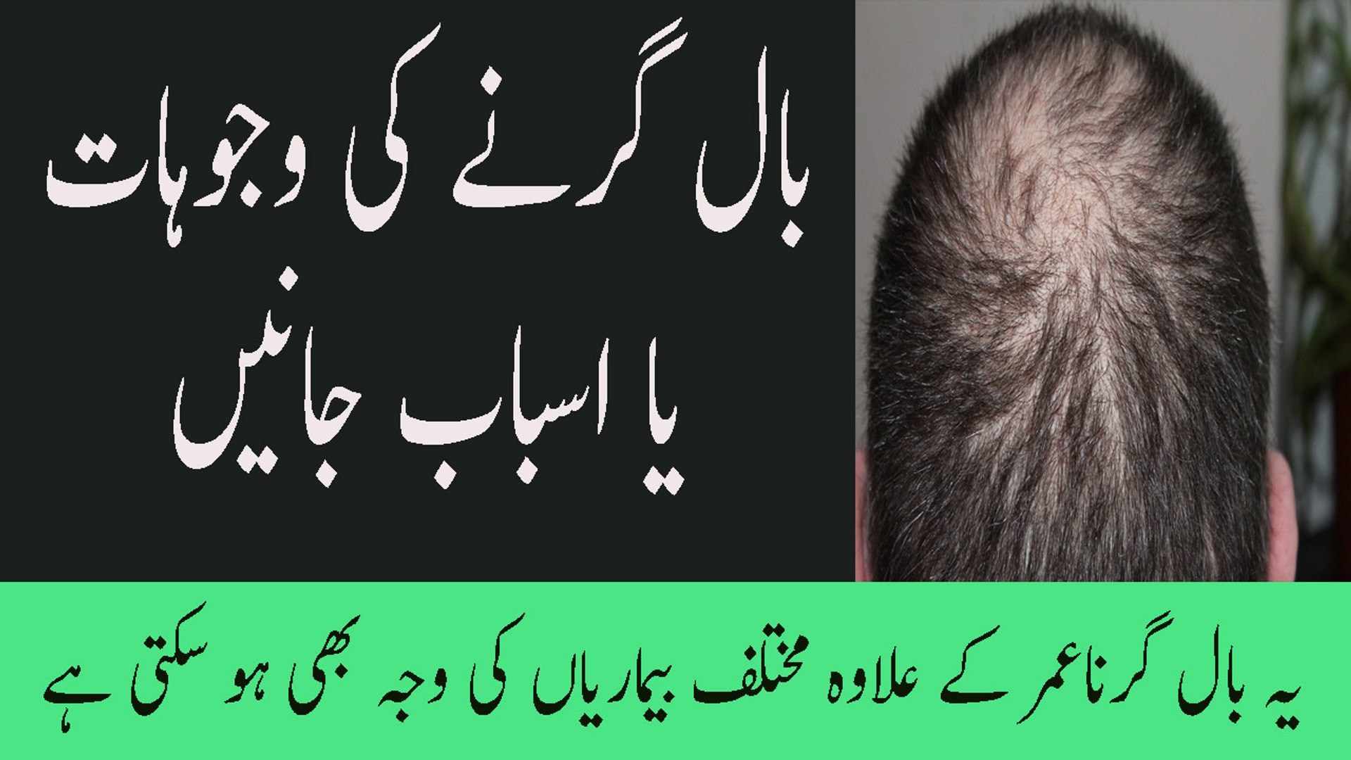 Bal Girne Ki Waja Hair Fall And Loss Reason In Urdu Baal Kyu Girte Hain -  video Dailymotion