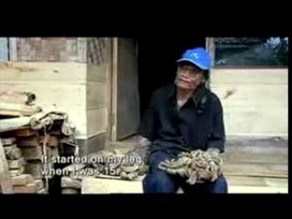 l'Homme-Arbre [Tree Man]