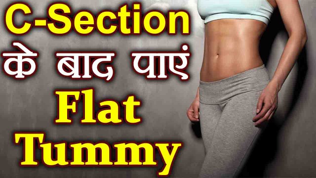 Weight Loss after Pregnancy | C-Section के बाद आसान तरीकों से पाएं Flat Tummy | Boldsky