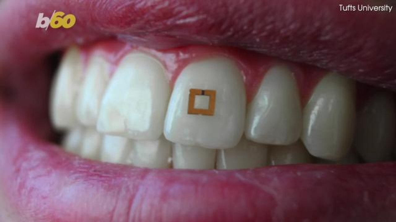 Forget the FitBit... A Tooth-Mounted Chip May Soon Track Nutrition