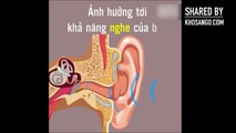 Bạn có dùng bông ngoáy tai hàng ngày Hãy xem video để biết tác hại việc đó.