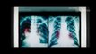 Marvels VENOM (2018) Full Trailer #1 Tom Hardy Marvel Movie [HD]