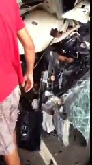 Girl loves make up after car crash