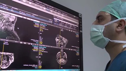 Beyin Cerrahide Dünyanın İlk "Robotik"Ameliyatı Türkiye'den