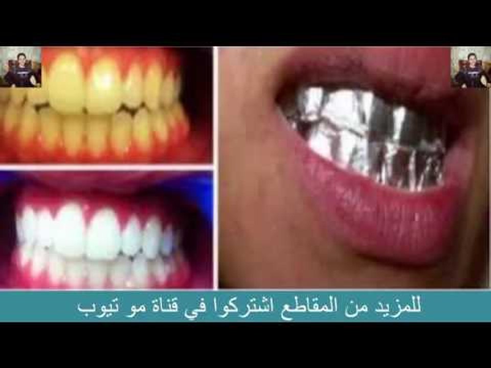 هل تعلم ماذا يحدث عندما نضع ورق الالمنيوم على اسناننا ؟؟؟؟ سبحان الله mo tube