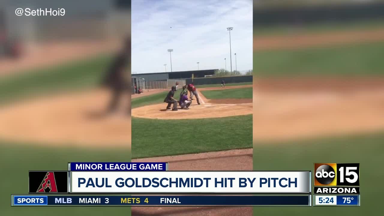 Paul Goldschmidt hit in head by pitch - ABC15 Sports