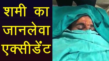 Mohammad Shami suffers serious head injury in car accident । वनइंडिया हिंदी