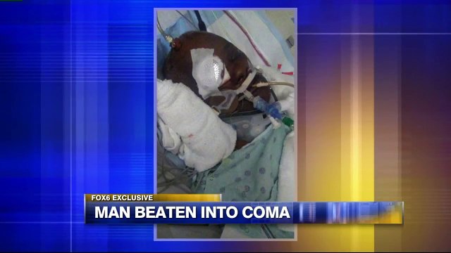Man Remains in Coma Weeks After Being Attacked by Acquaintance During Attempted Carjacking