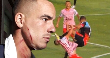 Arjantinli Futbolcu, Rakibine Uçan Tekme Attı