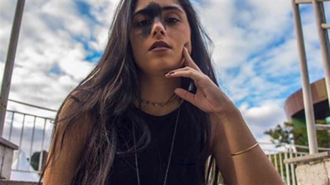 Trotz großem Muttermal im Gesicht: Model startet durch