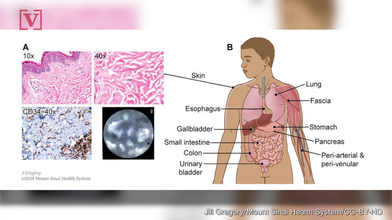Scientists Have 'Discovered a New Organ'
