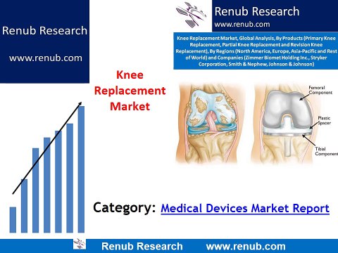 Knee Replacement Market is anticipated to exceed US$ 13 Billion