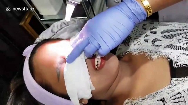 Woman left with giant slug-like eyebrows after botched tattoo job