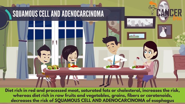 CancerBro explains risk factors of esophageal risk factors