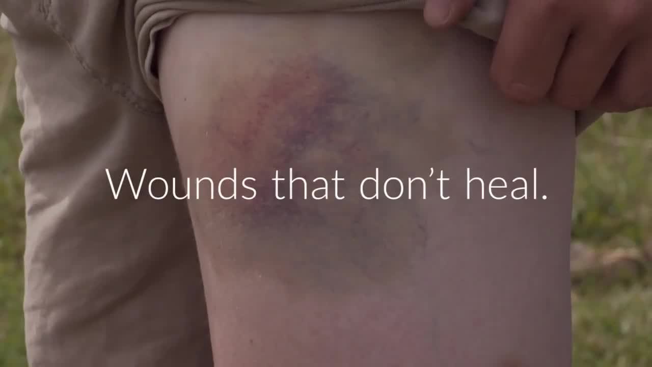 7 Diabetes Symptoms You Shouldn't Ignore