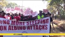 Malawi activists march to parliament over albino killings