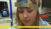 Electrical brain stimulation could help stroke patients recover rapidly