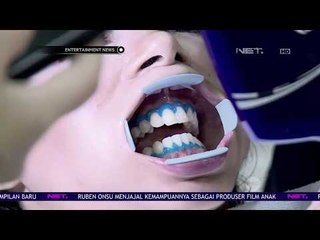 Perawatan Gigi Ala Dewi Rezer