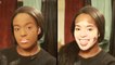 I Won’t Hide My Vitiligo With Makeup | SHAKE MY BEAUTY