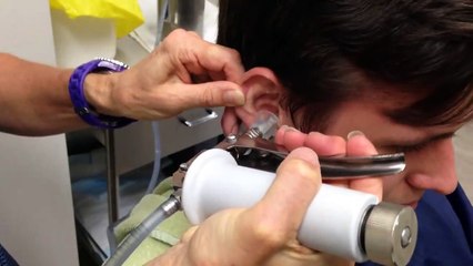 Ce qu'elle sort de l'oreille de cet homme est juste horrible