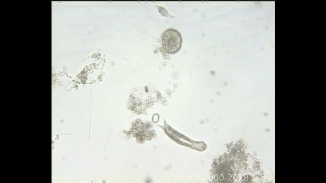 Divers microorganismes de la boue activée