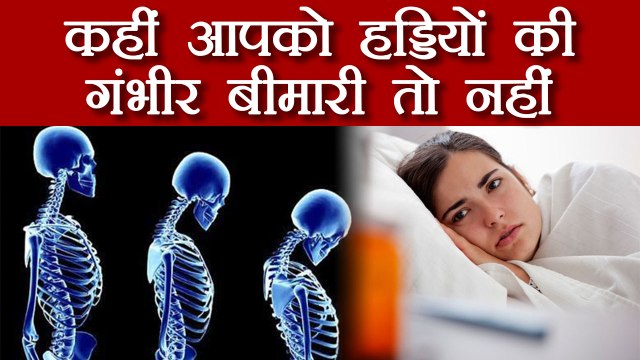 Osteoporosis : हड्डियों की 'खामोश बीमारी' से ऐसे बचें आप | Boldsky