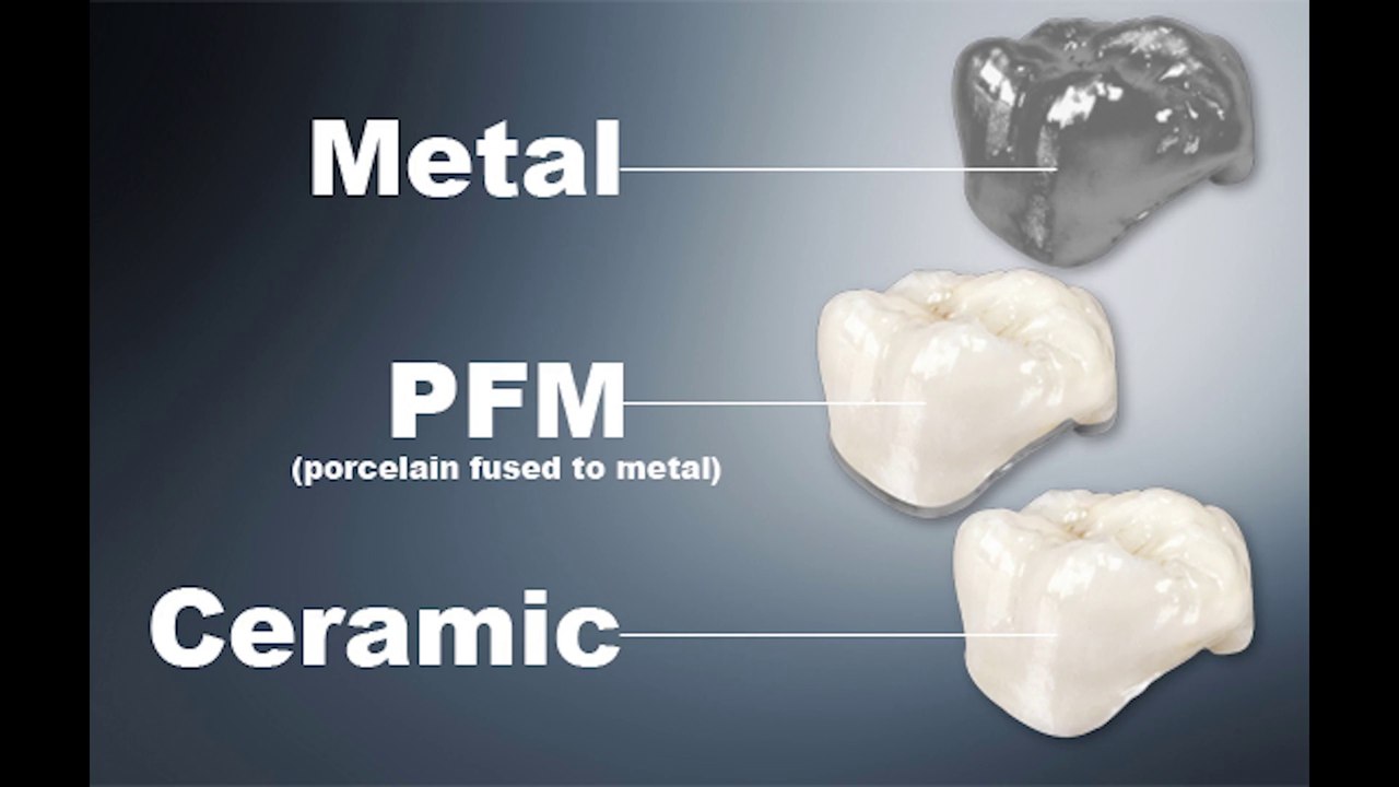 Molar Crown Preparation Walkthrough (tutorial) in the Simulation Lab