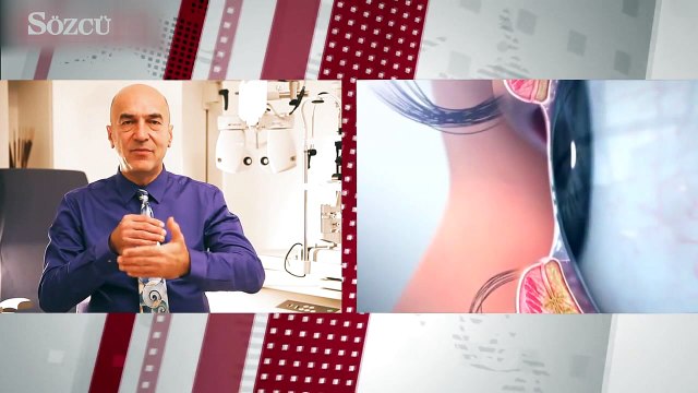 Kuru göz nedir, belirtileri nelerdir?